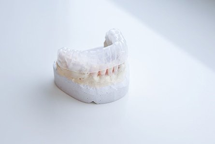 Invisalign1.jpg