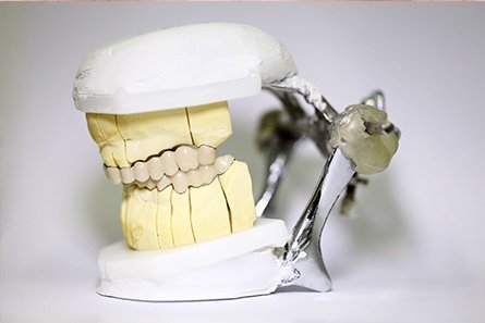 dentr_repair2.jpg